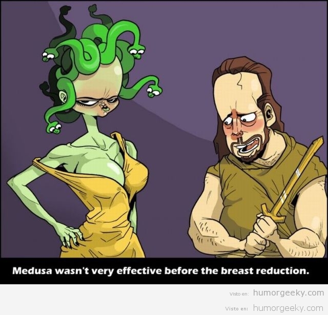 Medusa no era muy efectiva antes de su reducción de pechos