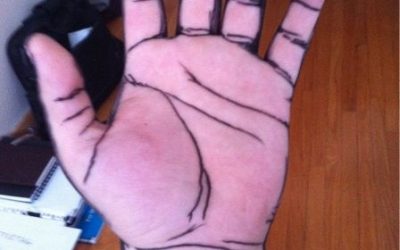 Qué le pasa a mi mano?