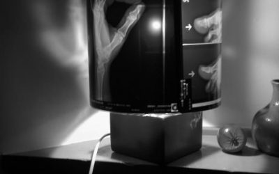 Lámpara radiografía
