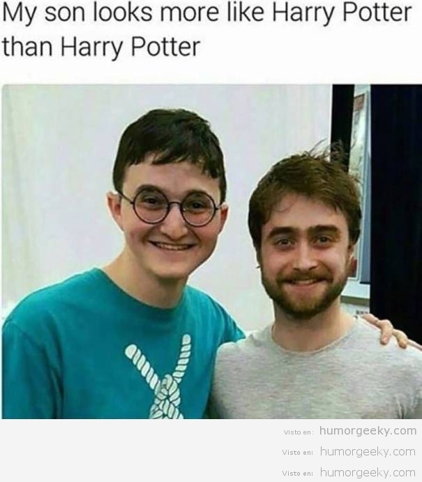 Cuando tu hijo se parece más a Harry Potter que el propio actor…